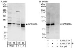 Detection of human SFRS17A by western blot and immunoprecipitation.