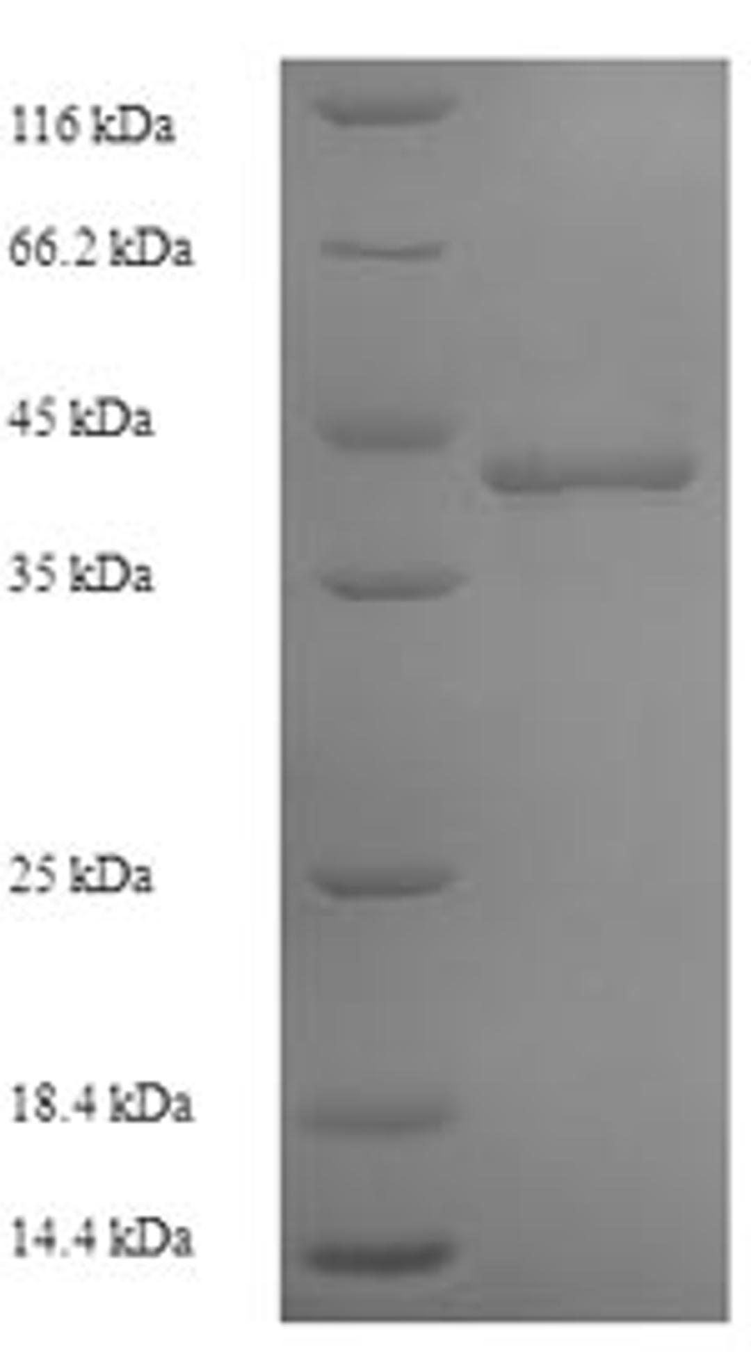 (Tris-Glycine gel) Discontinuous SDS-PAGE (reduced) with 5% enrichment gel and 15% separation gel.