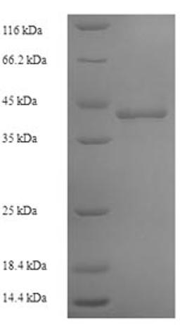 (Tris-Glycine gel) Discontinuous SDS-PAGE (reduced) with 5% enrichment gel and 15% separation gel.