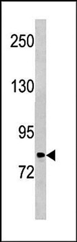 Western blot analysis of Hela cell line lysates (35ug/lane) using PLOD2 antibody (C-term)