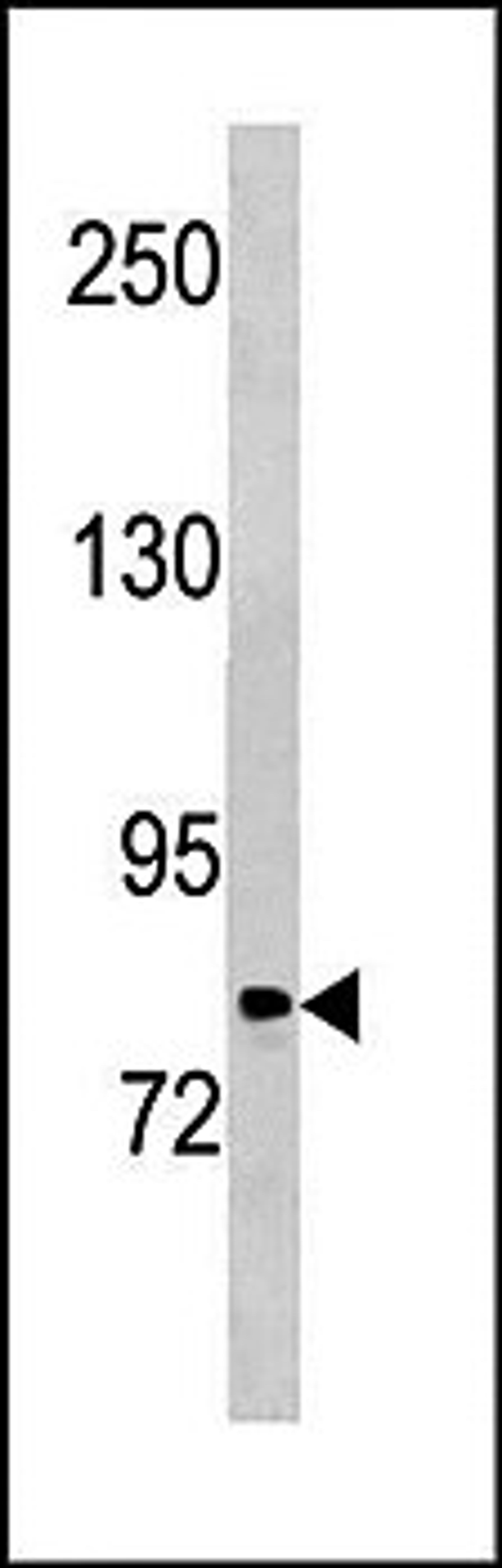 Western blot analysis of Hela cell line lysates (35ug/lane) using PLOD2 antibody (C-term)