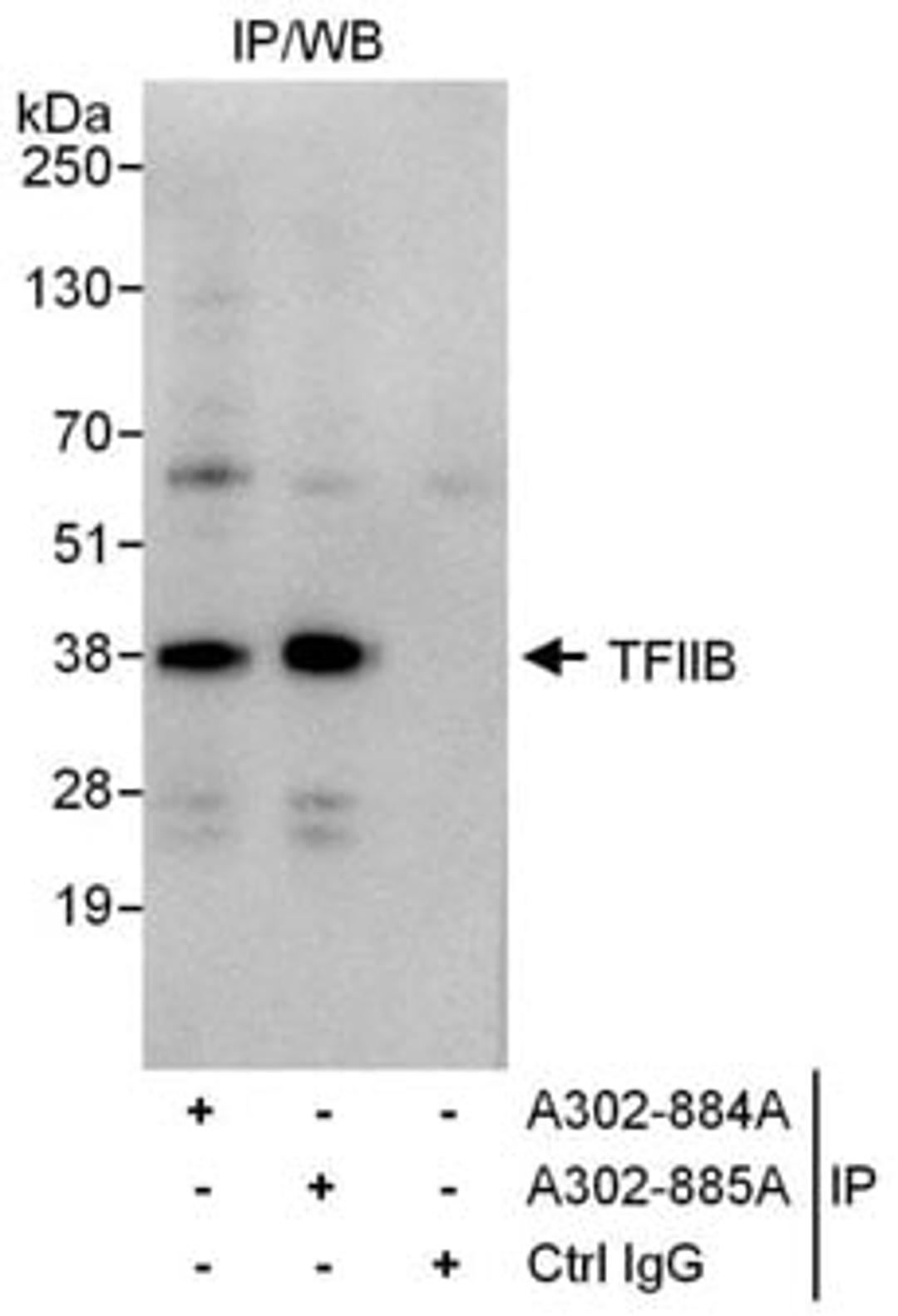 Detection of human GTF2B/ TFIIB by western blot of immunoprecipitates.