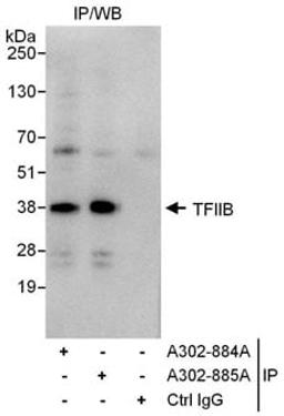 Detection of human GTF2B/ TFIIB by western blot of immunoprecipitates.