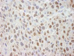 Detection of mouse Cul4a by immunohistochemistry.