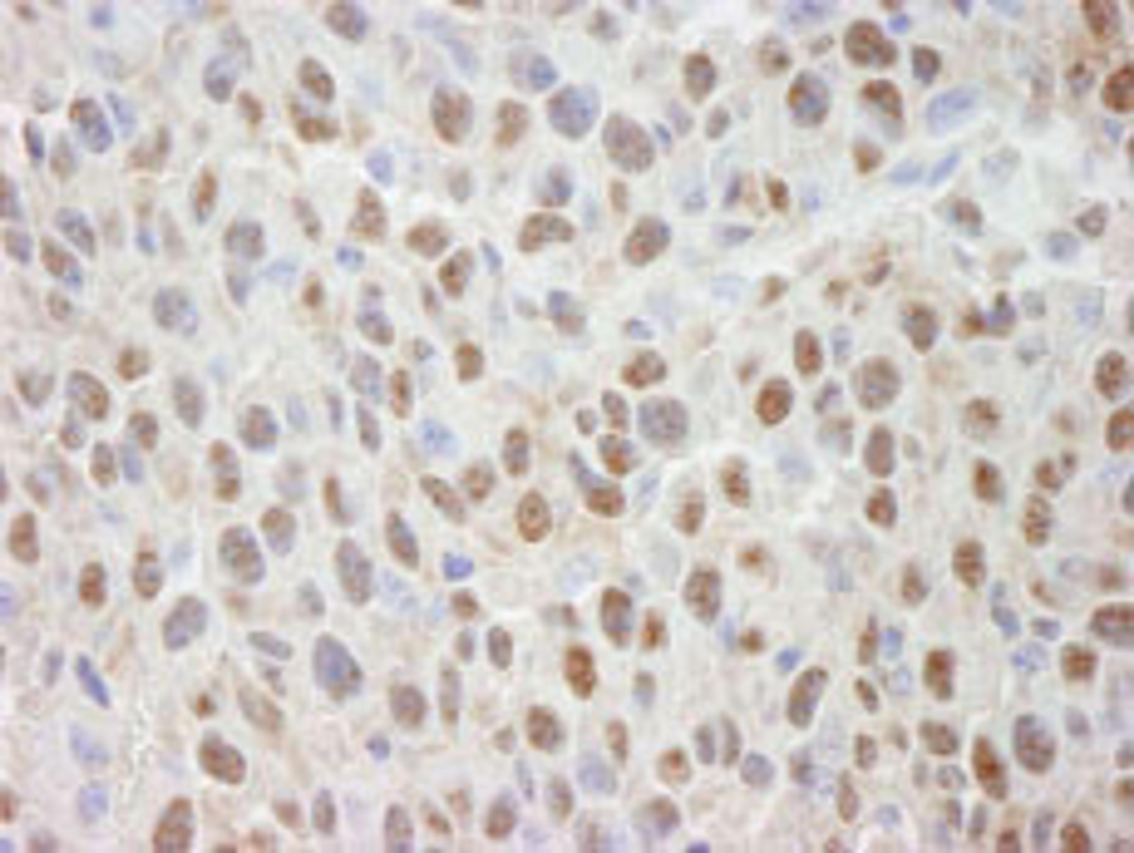 Detection of mouse Cul4a by immunohistochemistry.