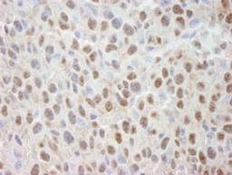 Detection of mouse Cul4a by immunohistochemistry.