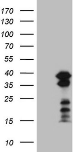 Western Blot: BOB1 Antibody (2D4) [NBP2-45374] - Analysis of HEK293T cells were transfected with the pCMV6-ENTRY control (Left lane) or pCMV6-ENTRY BOB1.