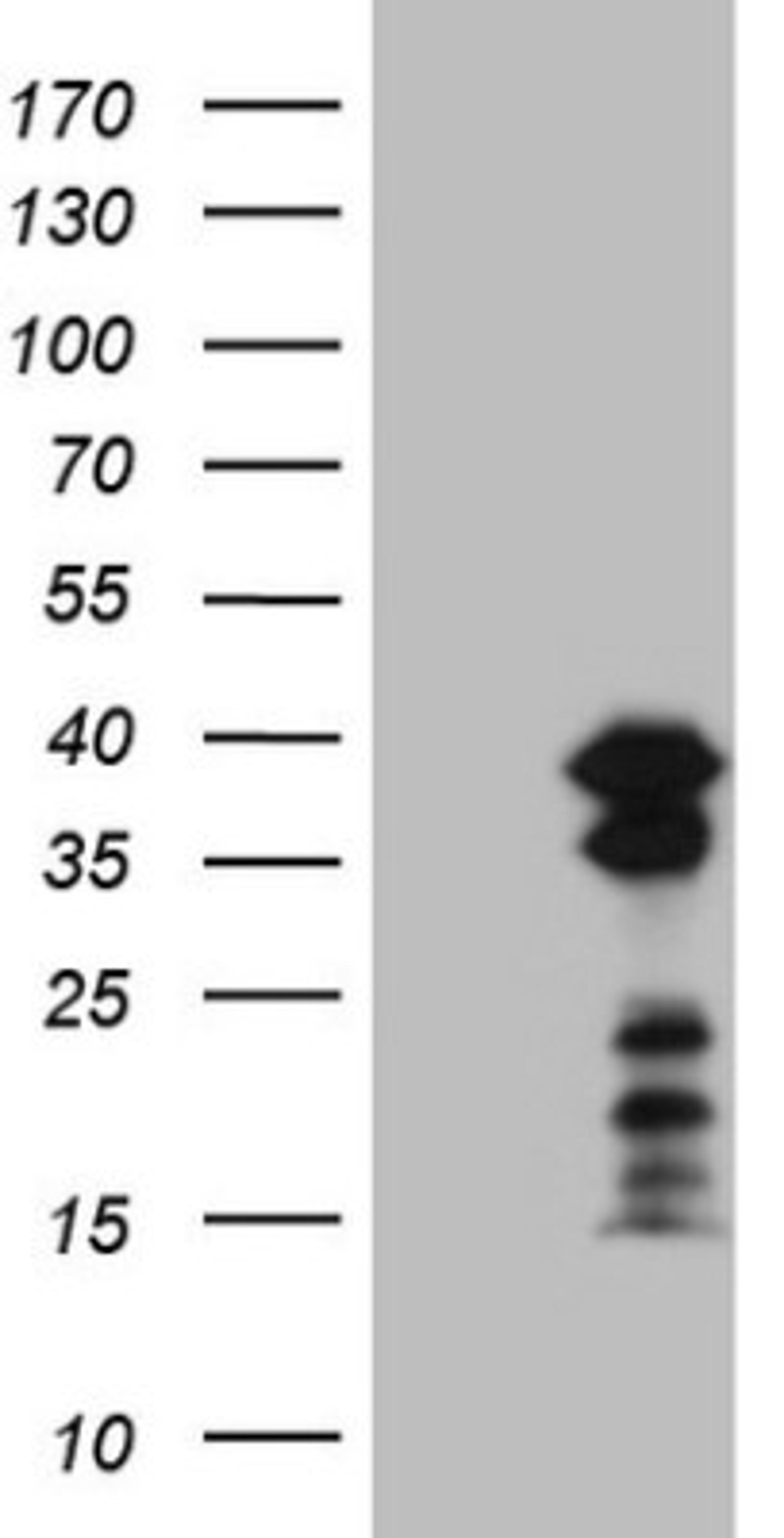 Western Blot: BOB1 Antibody (2D4) [NBP2-45374] - Analysis of HEK293T cells were transfected with the pCMV6-ENTRY control (Left lane) or pCMV6-ENTRY BOB1.