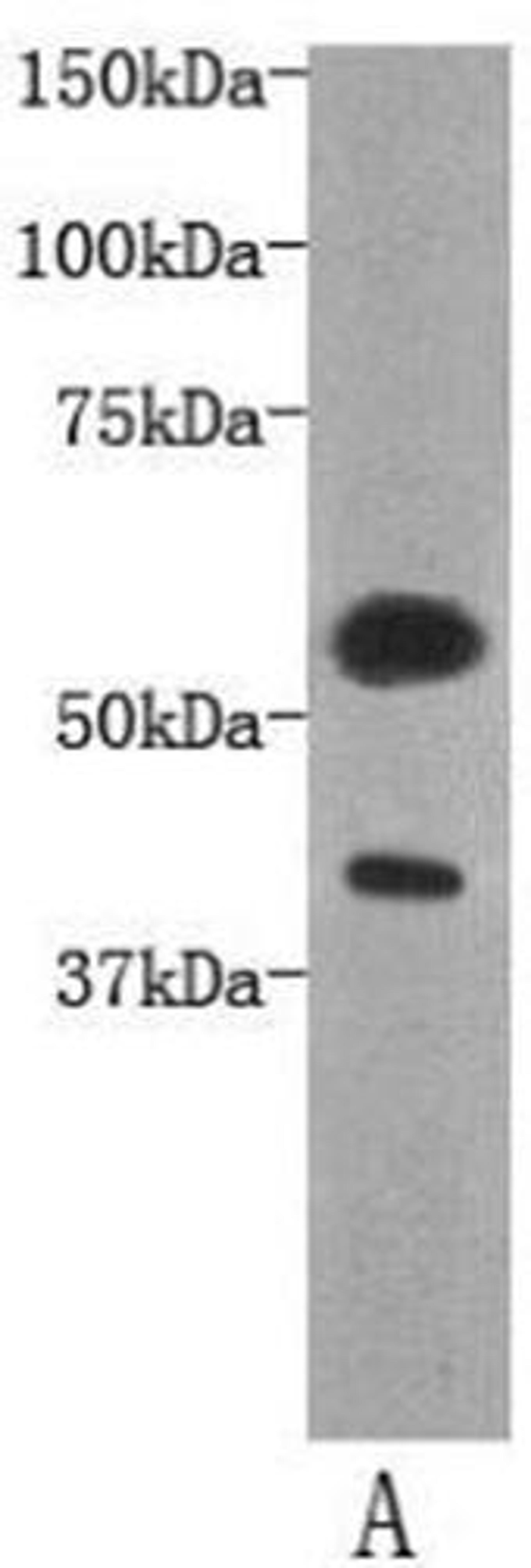 Western blot analysis of human kidney tissue using Transmembrane protein 57 antibody