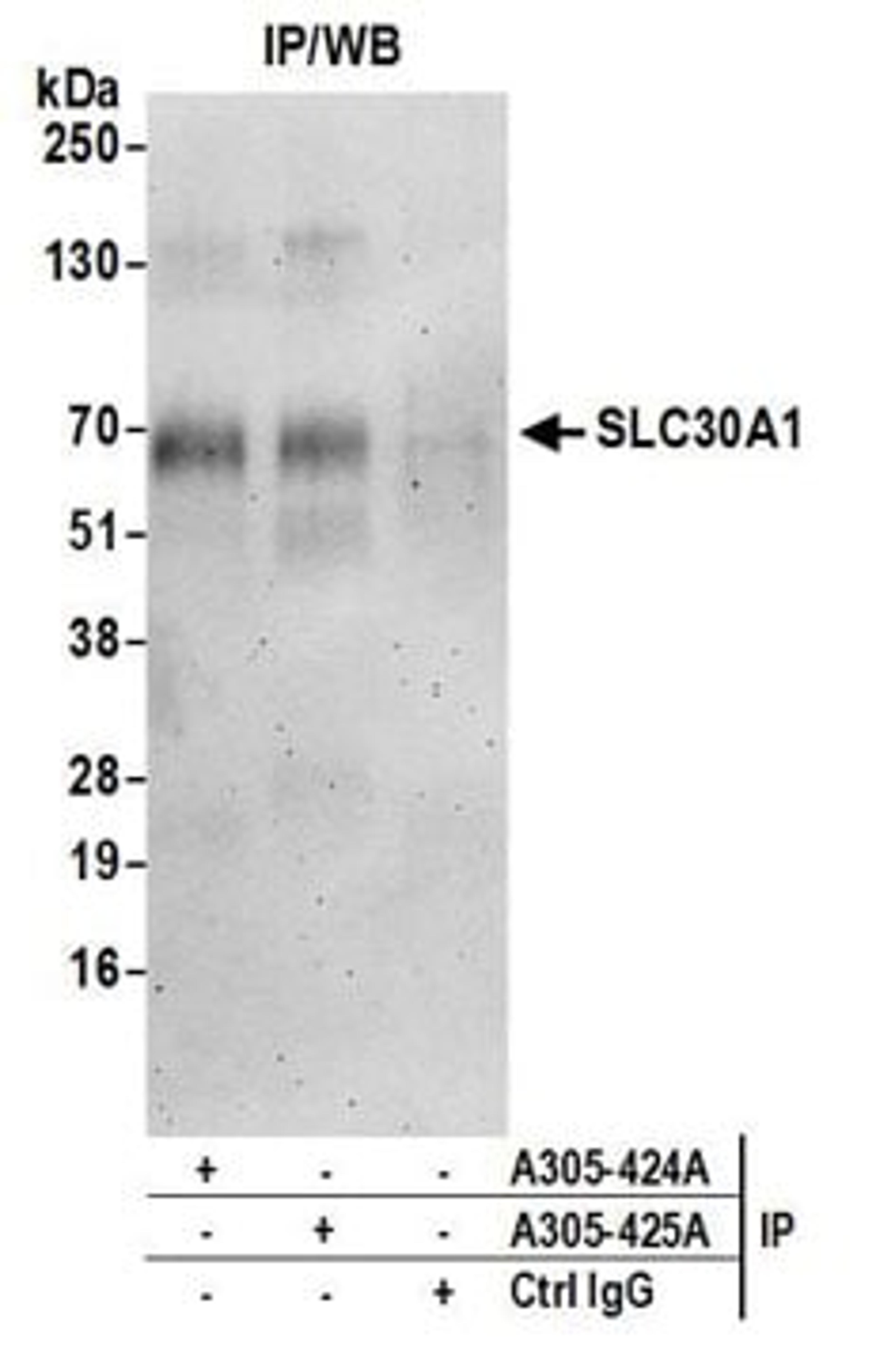 Detection of human SLC30A1 by western blot of immunoprecipitates.