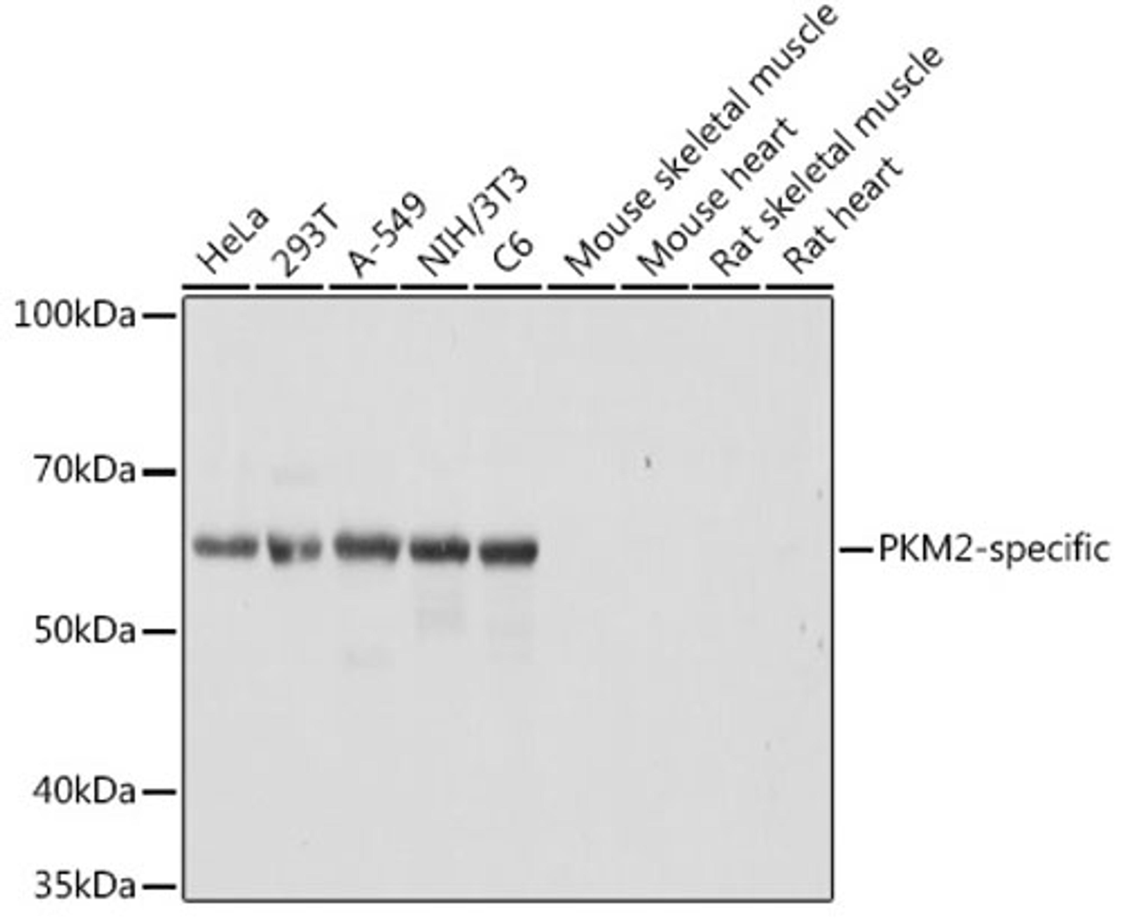 Western blot - PKM2-specific antibody (A18799)