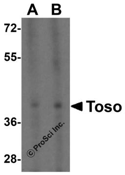 Western blot analysis of TOSO in K562 cell lysate with TOSO antibody at (A) 1 and (B) 2 &#956;g/mL.