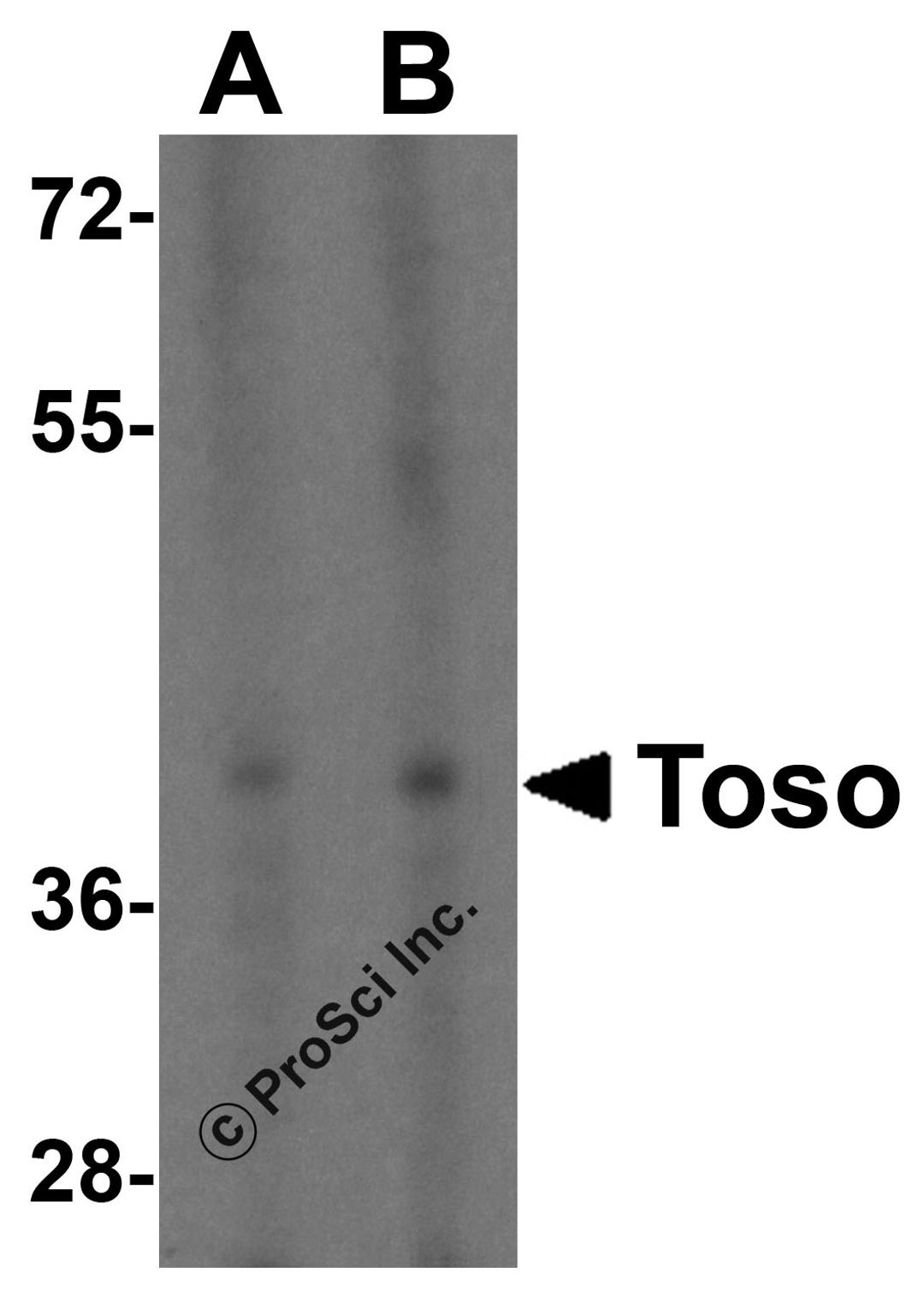 Western blot analysis of TOSO in K562 cell lysate with TOSO antibody at (A) 1 and (B) 2 μg/mL.