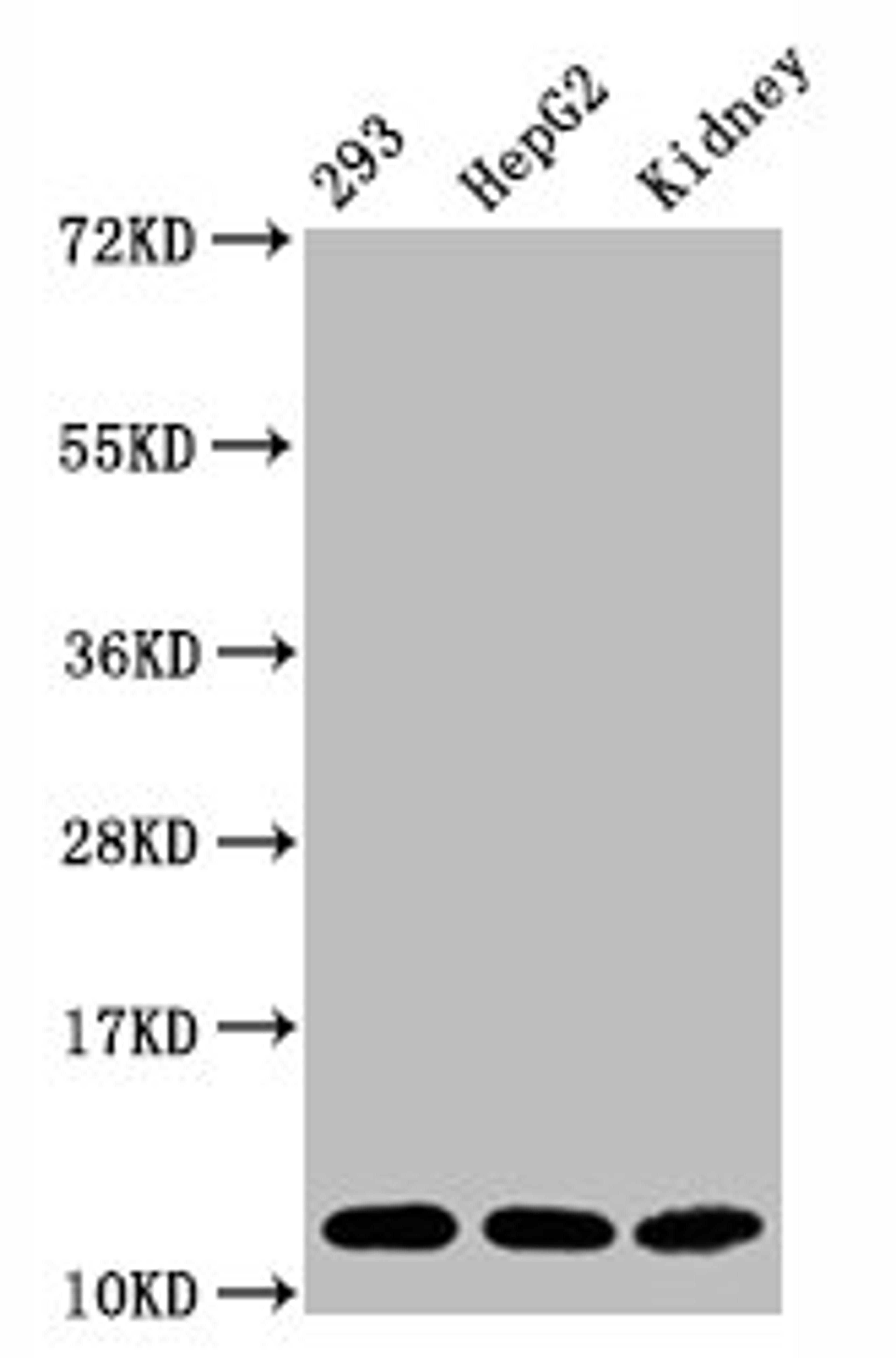 Western Blot. Positive WB detected in:293 whole cell lysate, HepG2 whole cell lysate, Mouse kidney tissue. All lanes:Acetyl-Histone H4 (K16) antibody at 1.65μg/ml. Secondary. Goat polyclonal to rabbit IgG at 1/50000 dilution. Predicted band size: 11 KDa. Observed band size: 11 KDa.