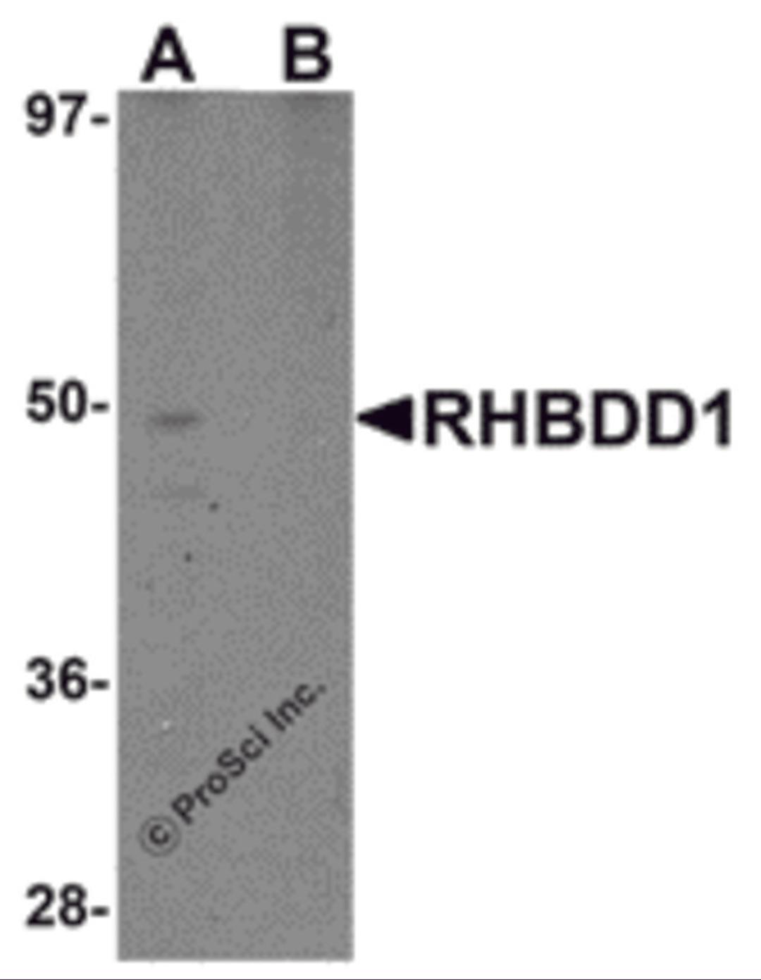 Western blot analysis of RHBDD1 in K562 cell lysate with RHBDD1 antibody at 1 μg/mL in (A) the absence and (B) the presence of blocking peptide.