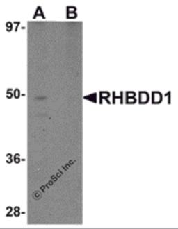 Western blot analysis of RHBDD1 in K562 cell lysate with RHBDD1 antibody at 1 μg/mL in (A) the absence and (B) the presence of blocking peptide.
