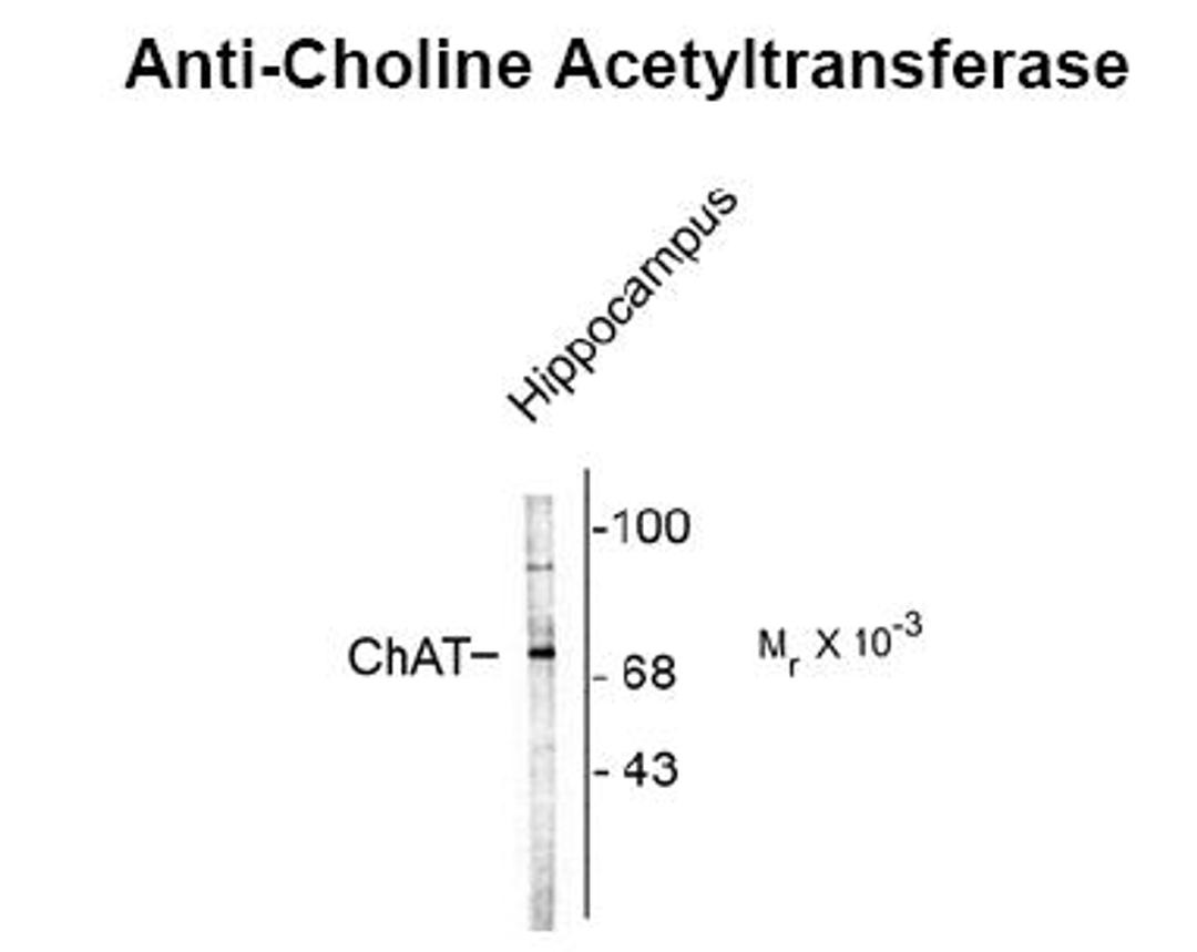 Western blot of rat brain lysate showing specific immunolabeling of the ~70k ChAT