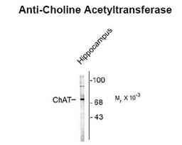 Western blot of rat brain lysate showing specific immunolabeling of the ~70k ChAT