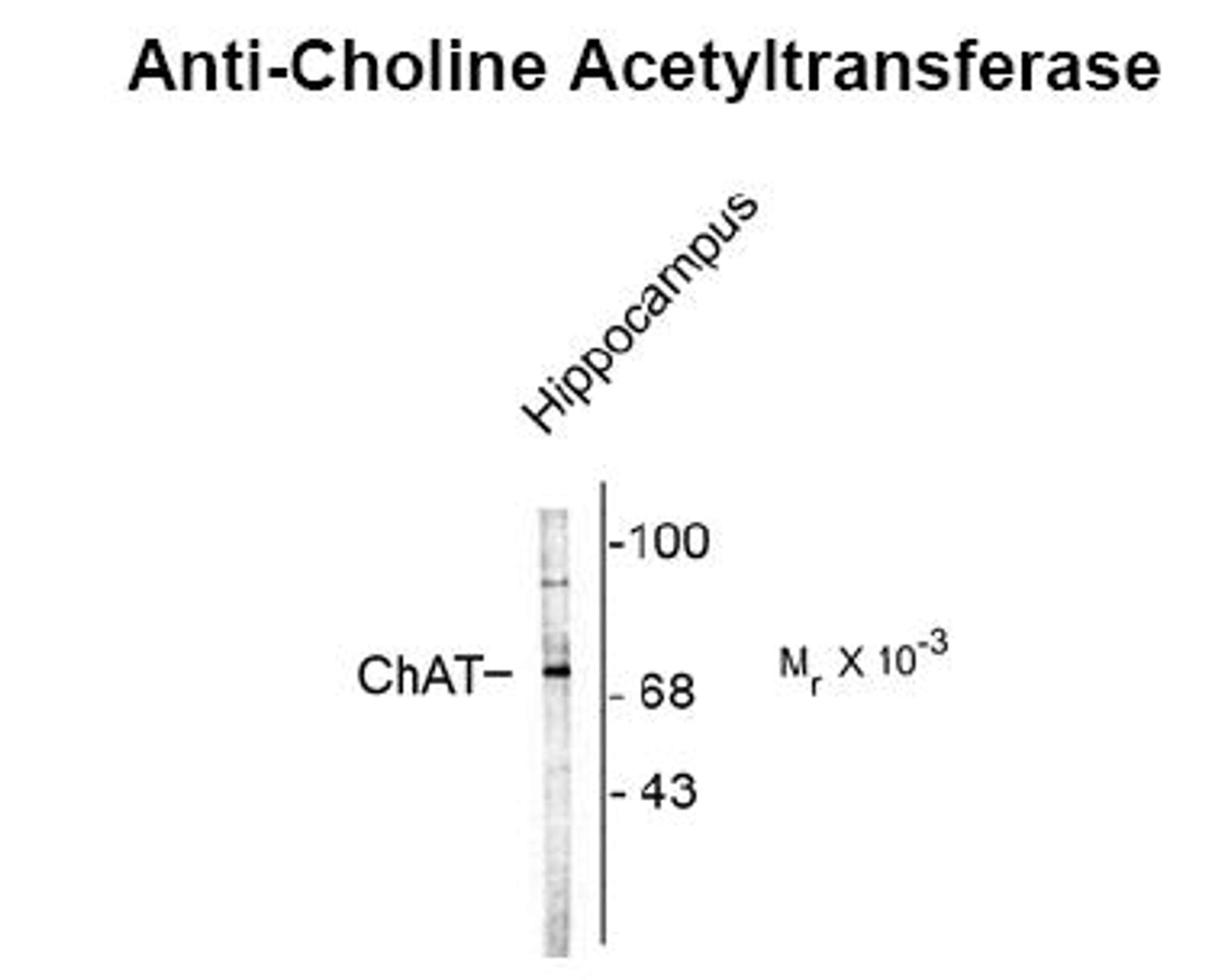 Western blot of rat brain lysate showing specific immunolabeling of the ~70k ChAT