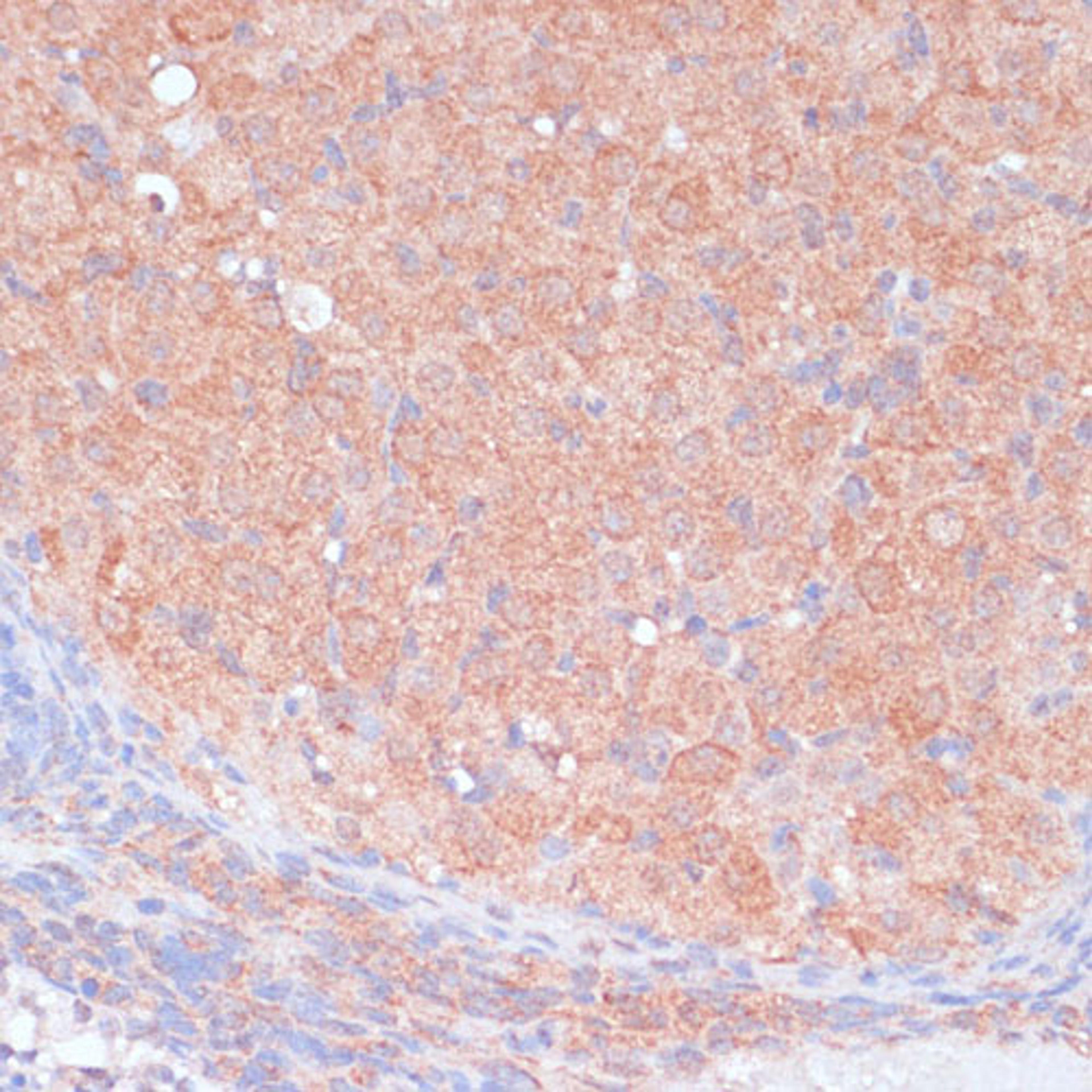 Immunohistochemistry  - LRP1 antibody (A1439)