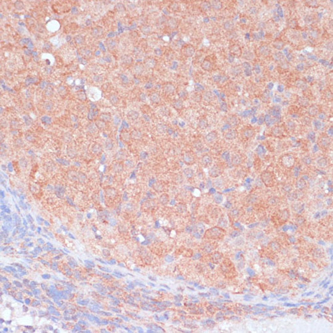 Immunohistochemistry - LRP1 antibody (A1439)