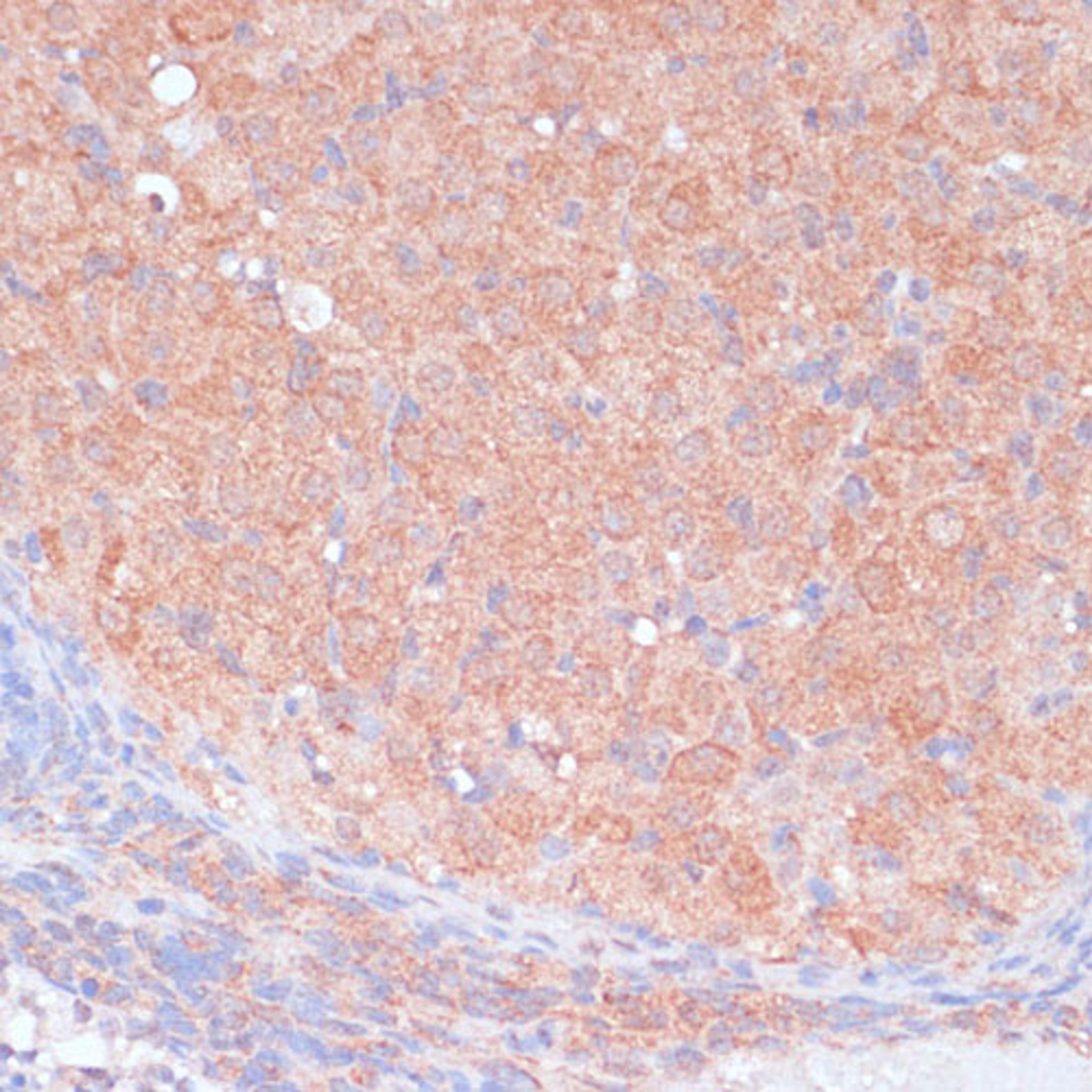 Immunohistochemistry - LRP1 antibody (A1439)
