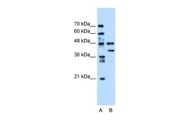 Antibody used in WB on Human Jurkat cells at 0.2-1 ug/ml.