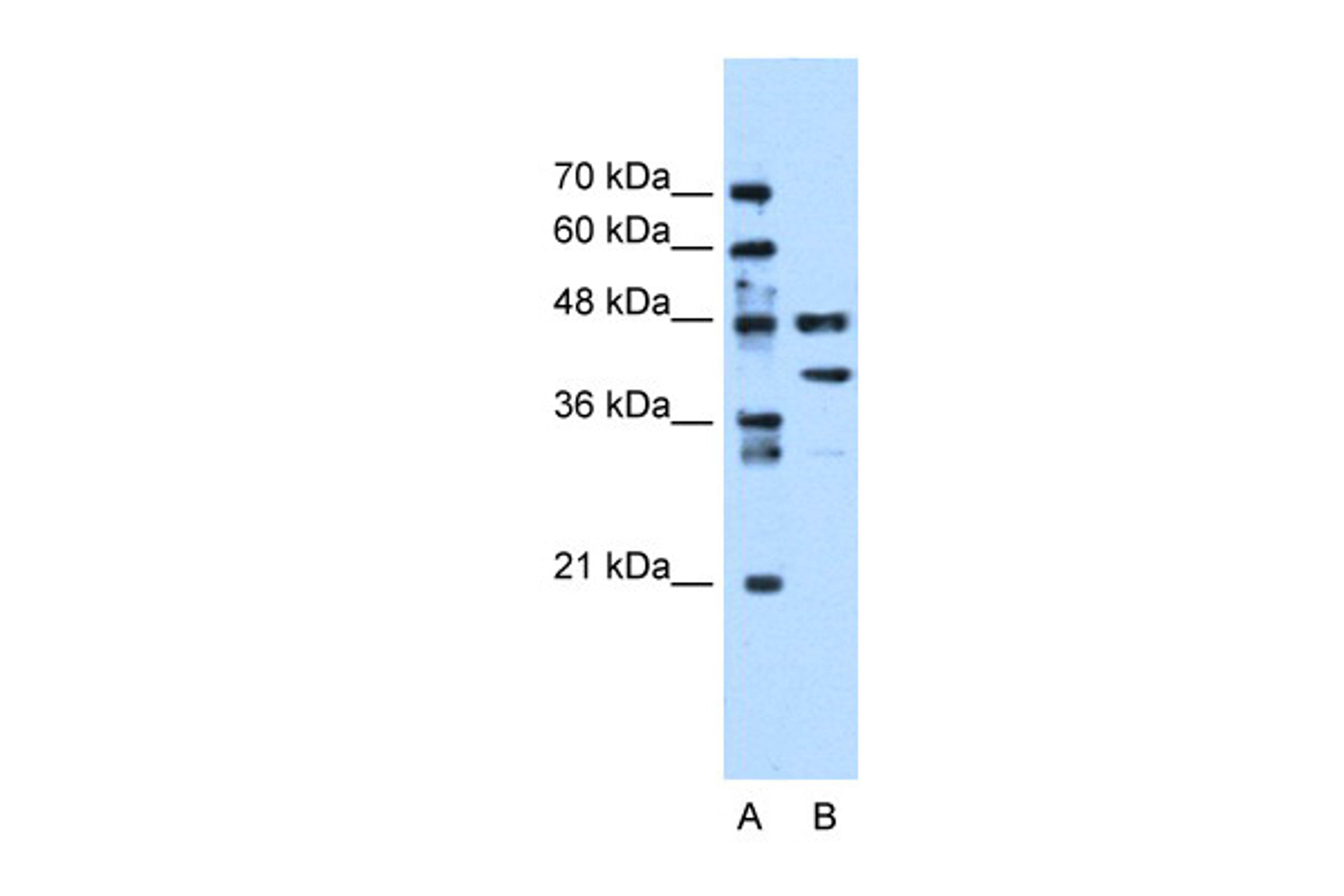 Antibody used in WB on Human Jurkat cells at 0.2-1 ug/ml.