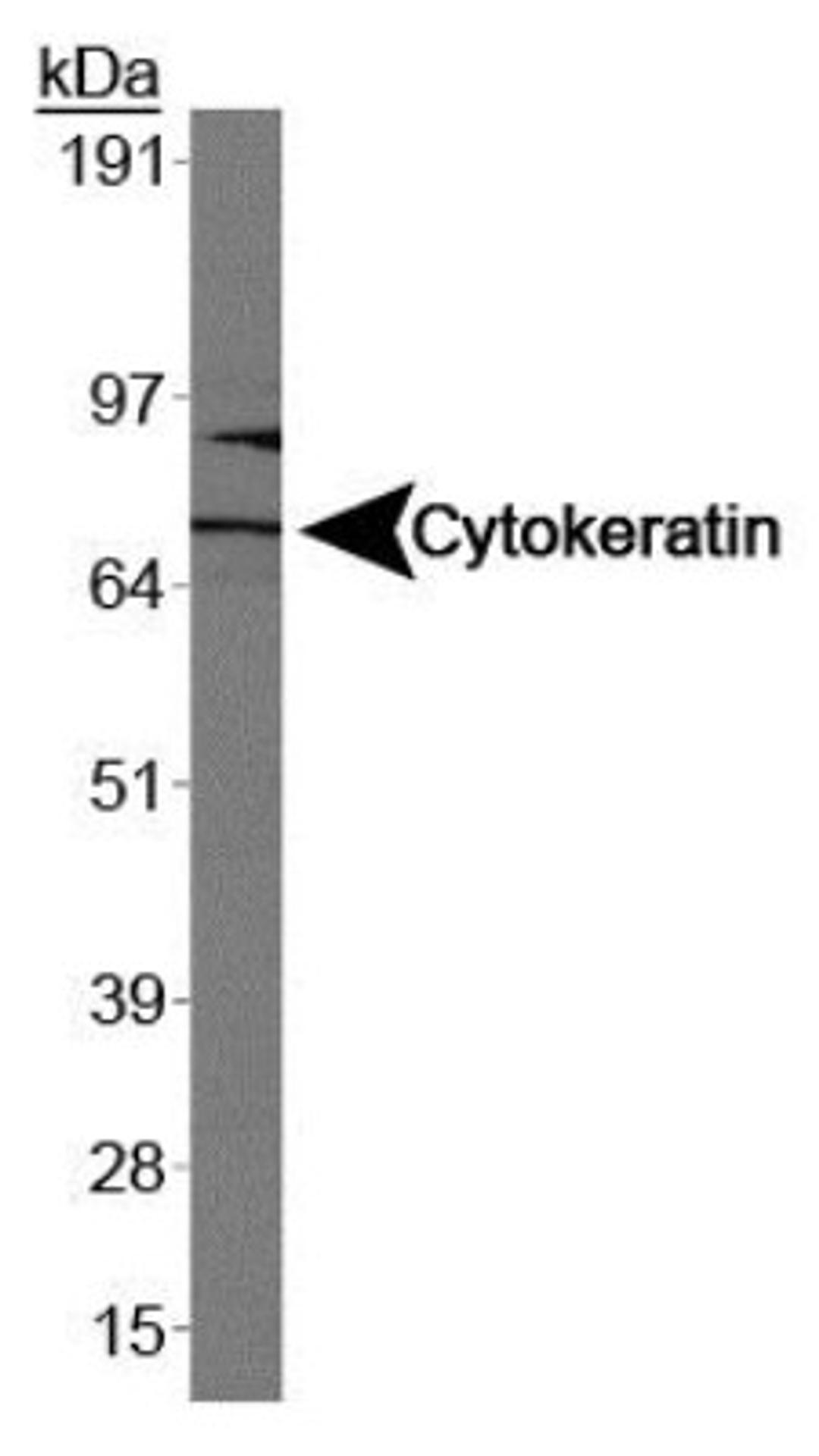 Western Blot: Cytokeratin 1 Antibody (LHK1) [NB100-2756] - Analysis of Cytokeratin 1 in Caco-2.