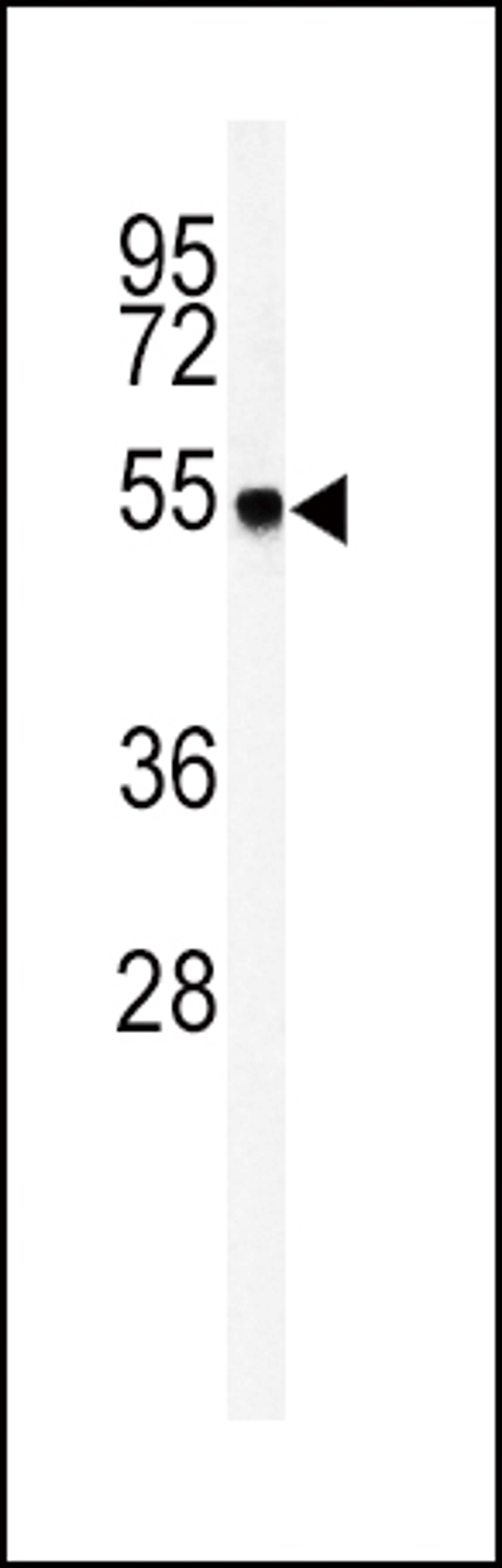 Western blot analysis of GOT1 Antibody in mouse liver tissue lysates (35ug/lane)