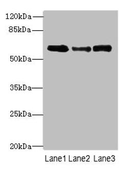 Western blot. All lanes: Smox antibody at 3µg/ml. Lane 1: PC-3 whole cell lysate. Lane 2: A549 whole cell lysate. Lane 3: 293T whole cell lysate. Secondary. Goat polyclonal to rabbit IgG at 1/10000 dilution. Predicted band size: 62, 66, 27, 23, 28, 60, 57, 47, 61, 21 kDa. Observed band size: 62 kDa
