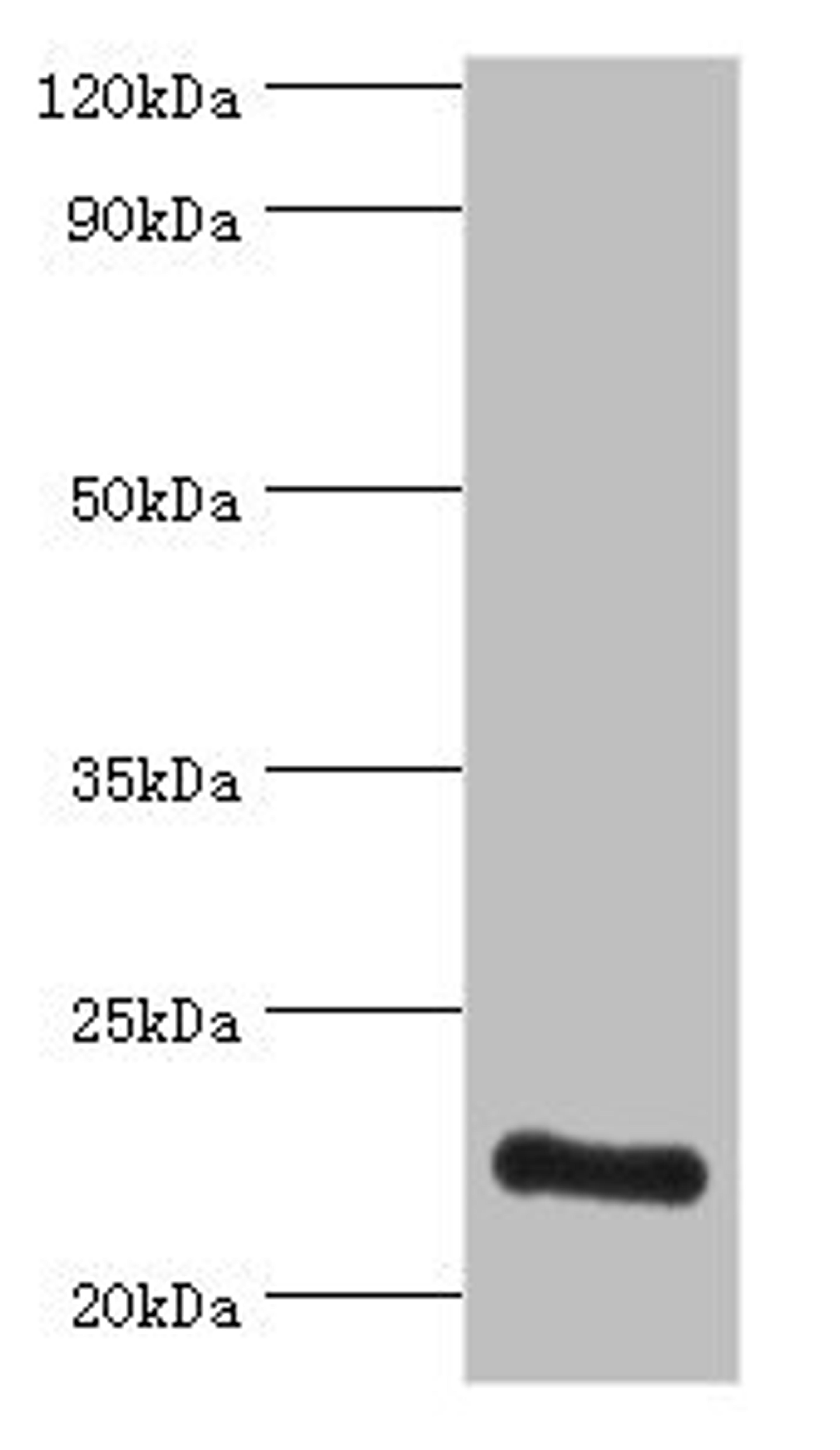 Western blot. All lanes: ATP5O antibody at 3ug/ml + HepG2 whole cell lysate. Secondary. Goat polyclonal to rabbit IgG at 1/10000 dilution. Predicted band size: 23 kDa. Observed band size: 23 kDa. 