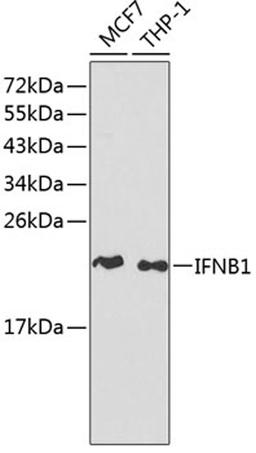 Western blot - IFNB1 antibody (A1575)