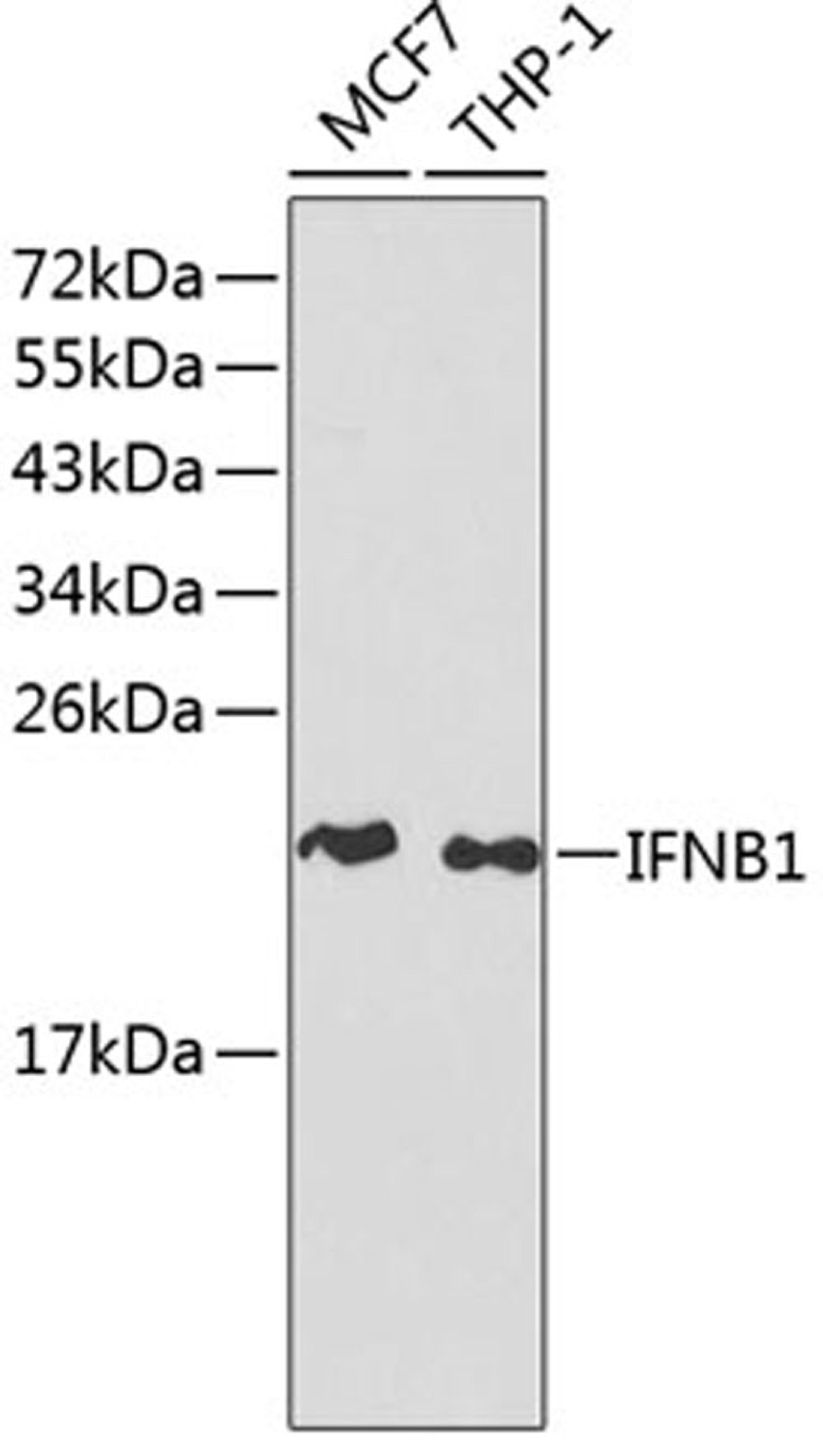 Western blot - IFNB1 antibody (A1575)