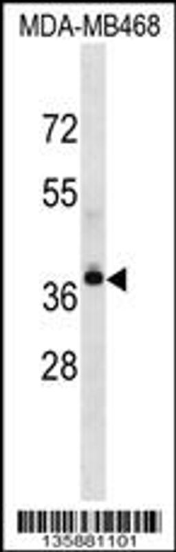 Western blot analysis in MDA-MB468 cell line lysates (35ug/lane).