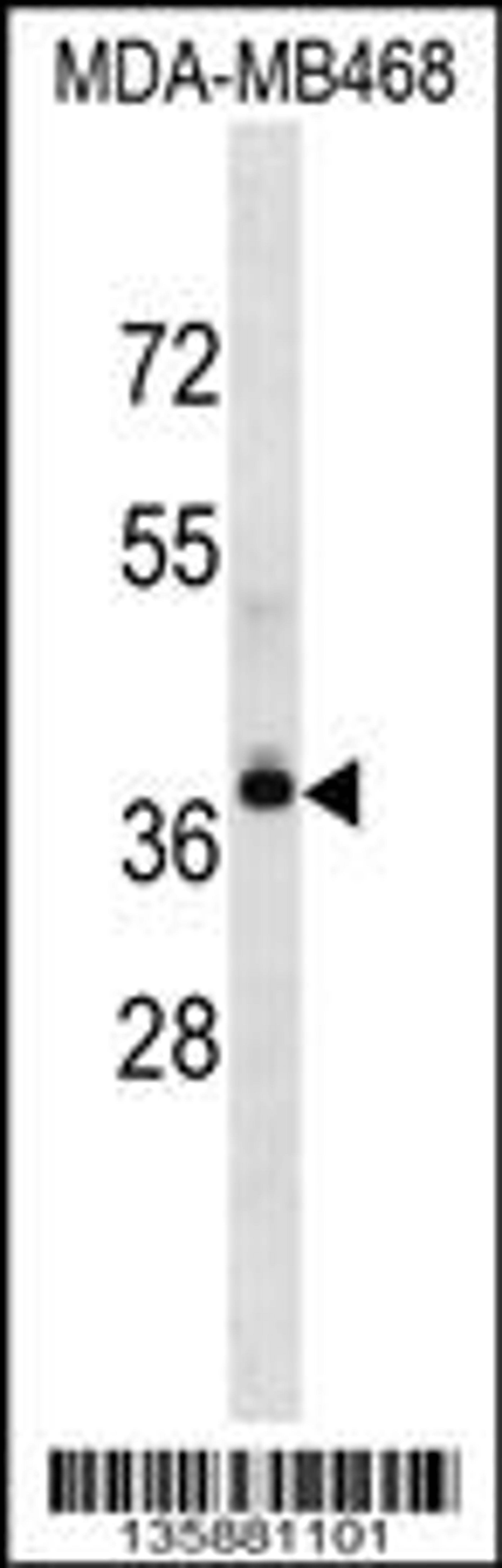 Western blot analysis in MDA-MB468 cell line lysates (35ug/lane).