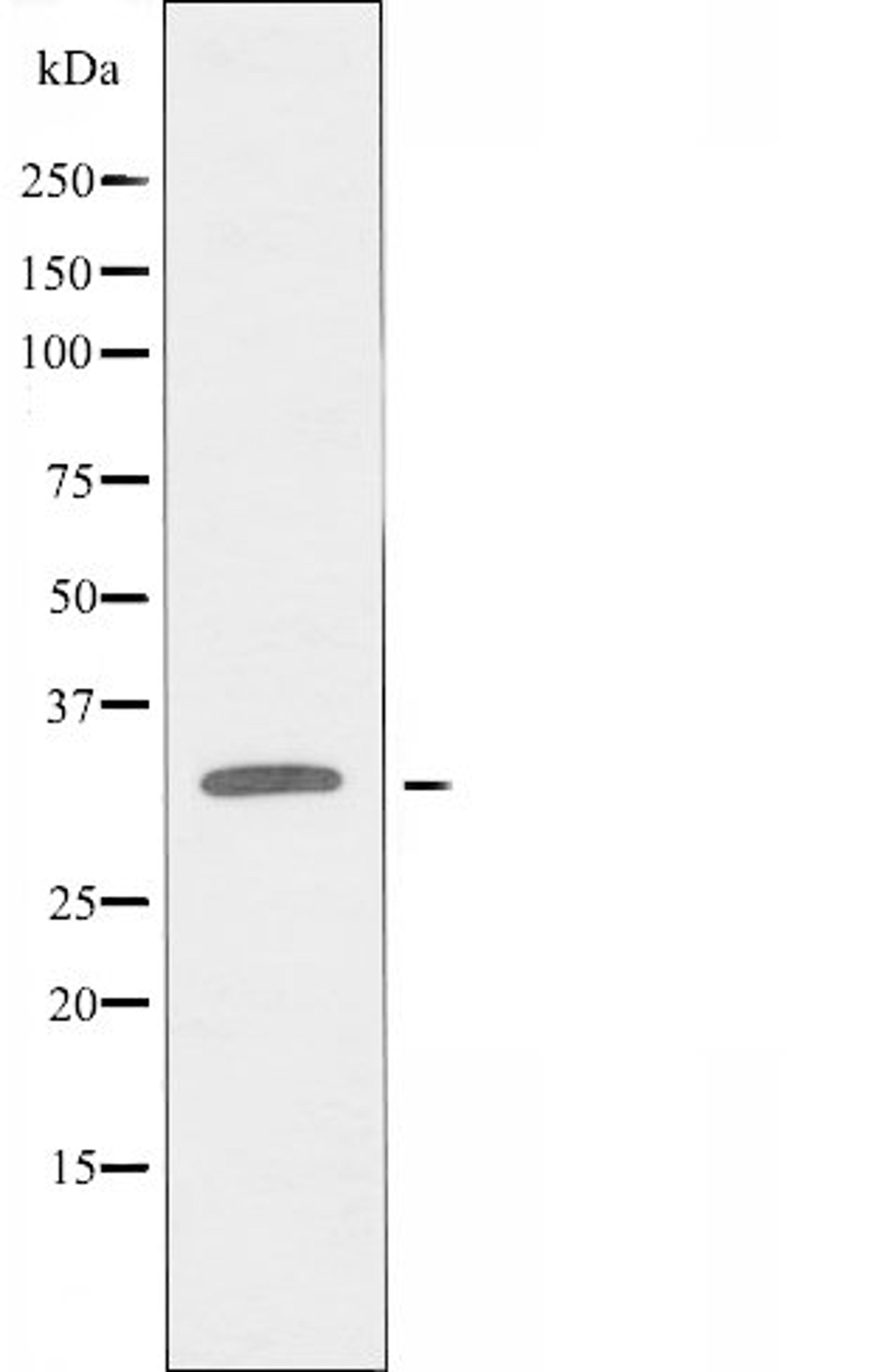 Western blot analysis of HUVEC cells using MRGRG antibody