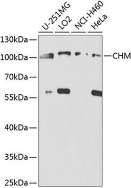 Western blot - CHM antibody (A8345)