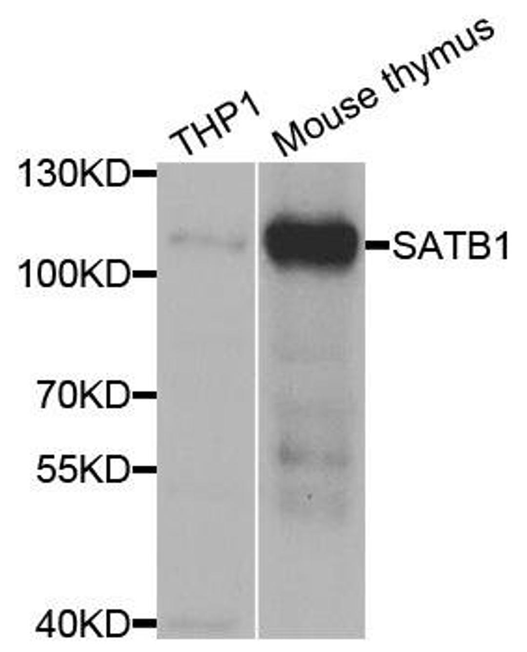 Western blot analysis of extracts of various cell lines using SATB1 antibody