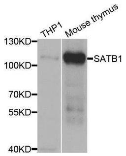 Western blot analysis of extracts of various cell lines using SATB1 antibody