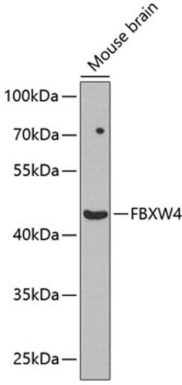 Western blot - FBXW4 antibody (A8149)