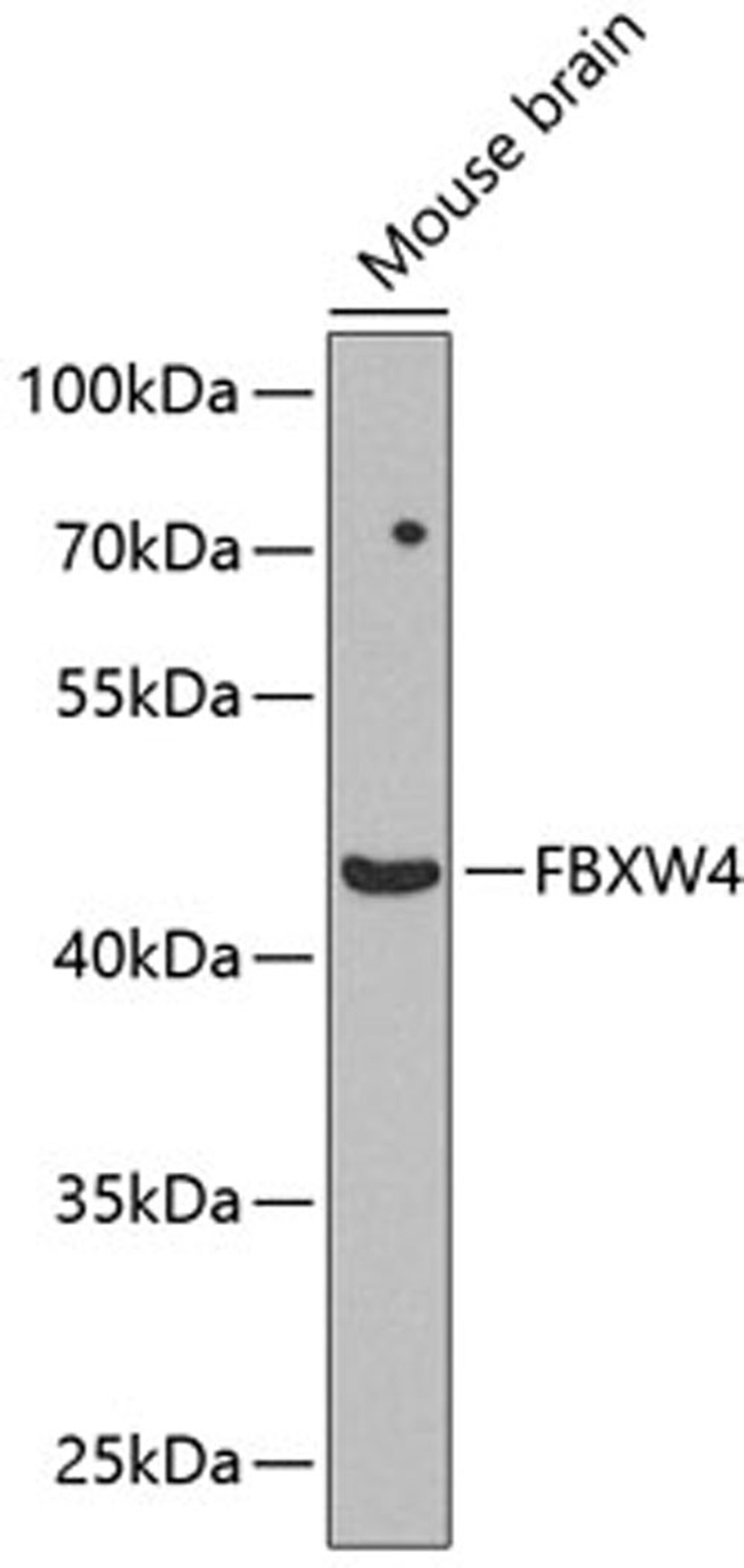 Western blot - FBXW4 antibody (A8149)