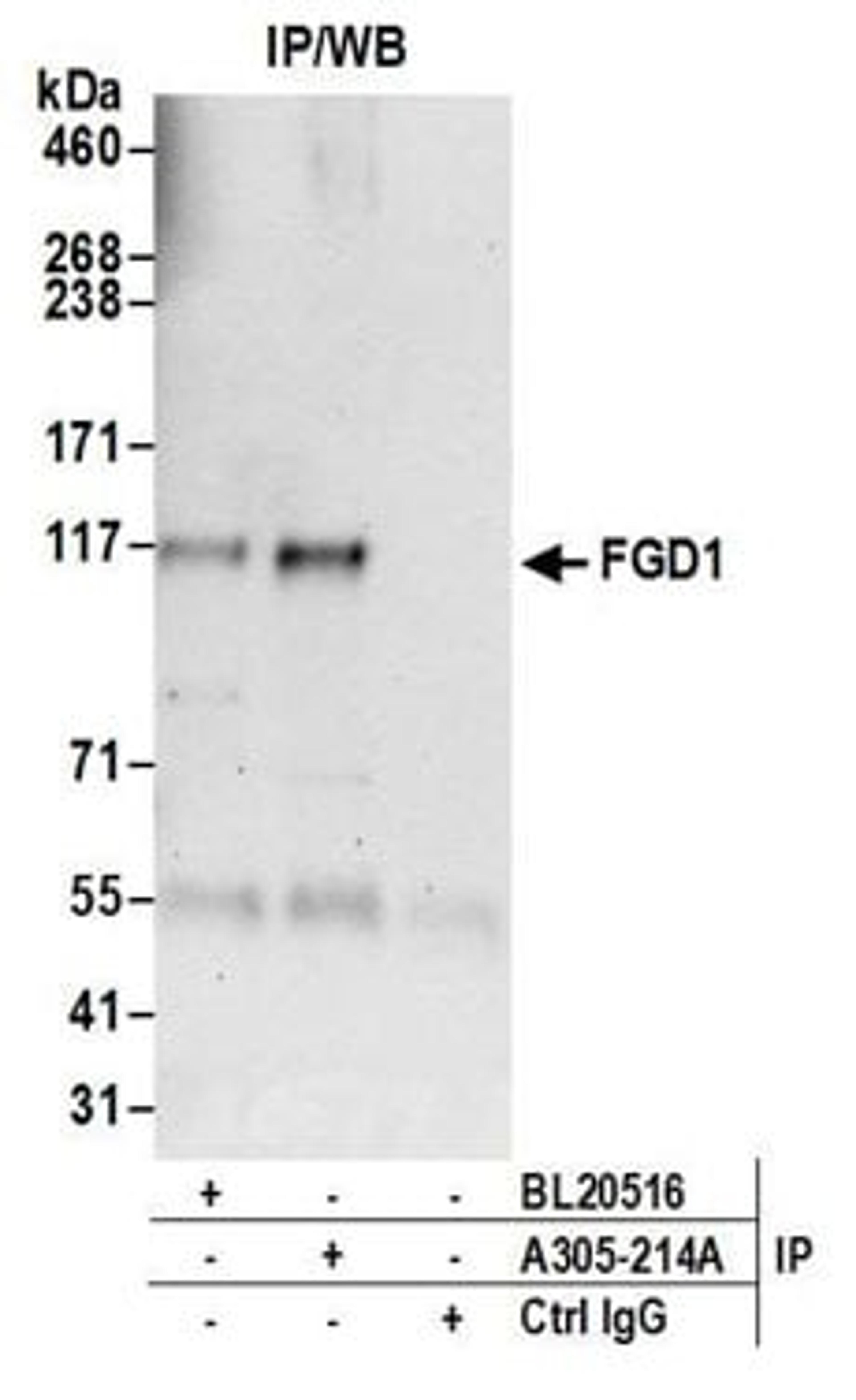 Detection of human FGD1 by western blot of immunoprecipitates.