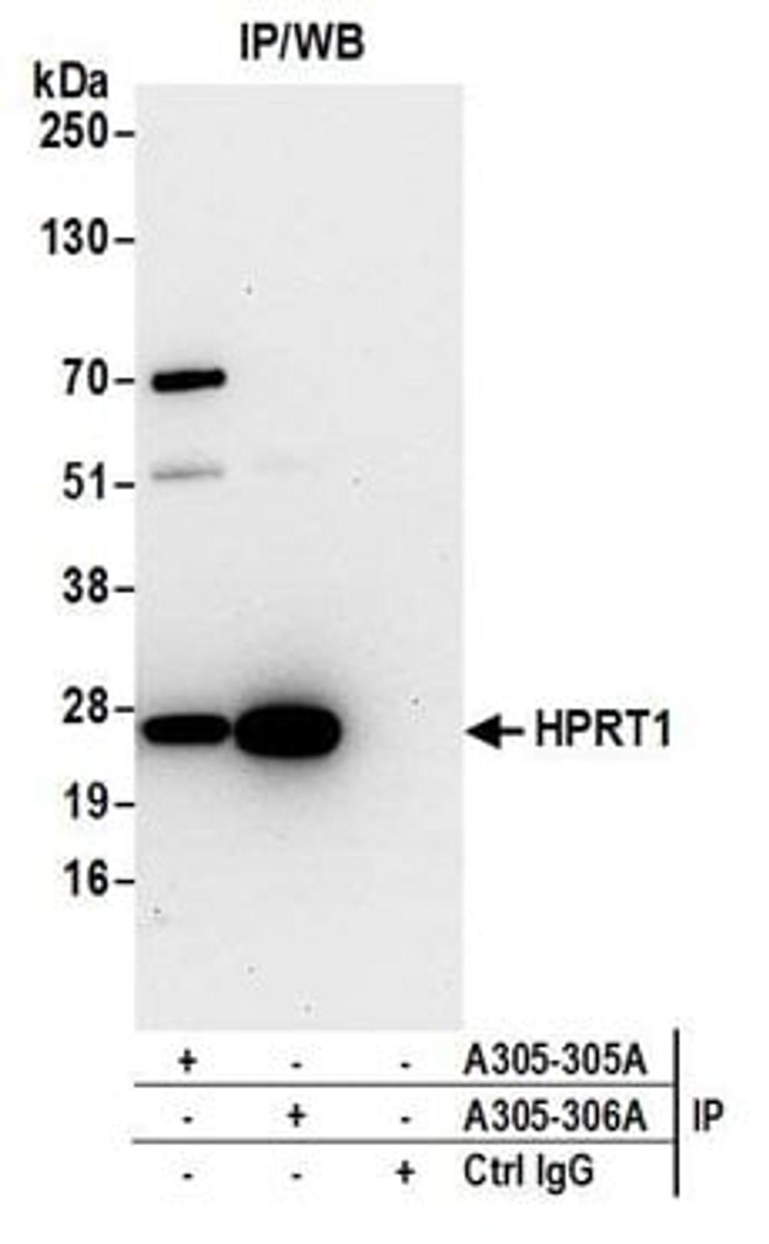 Detection of human HPRT1 by western blot of immunoprecipitates.