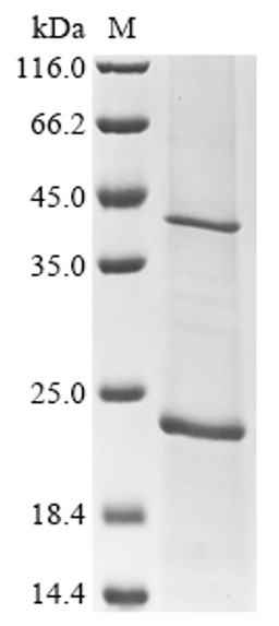 (Tris-Glycine gel) Discontinuous SDS-PAGE (reduced) with 5% enrichment gel and 15% separation gel.