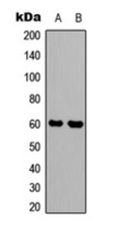 Western blot analysis of HEK293T (Lane 1), mouse brain (Lane 2) whole cell lysates using SYT1; SYT2 antibody