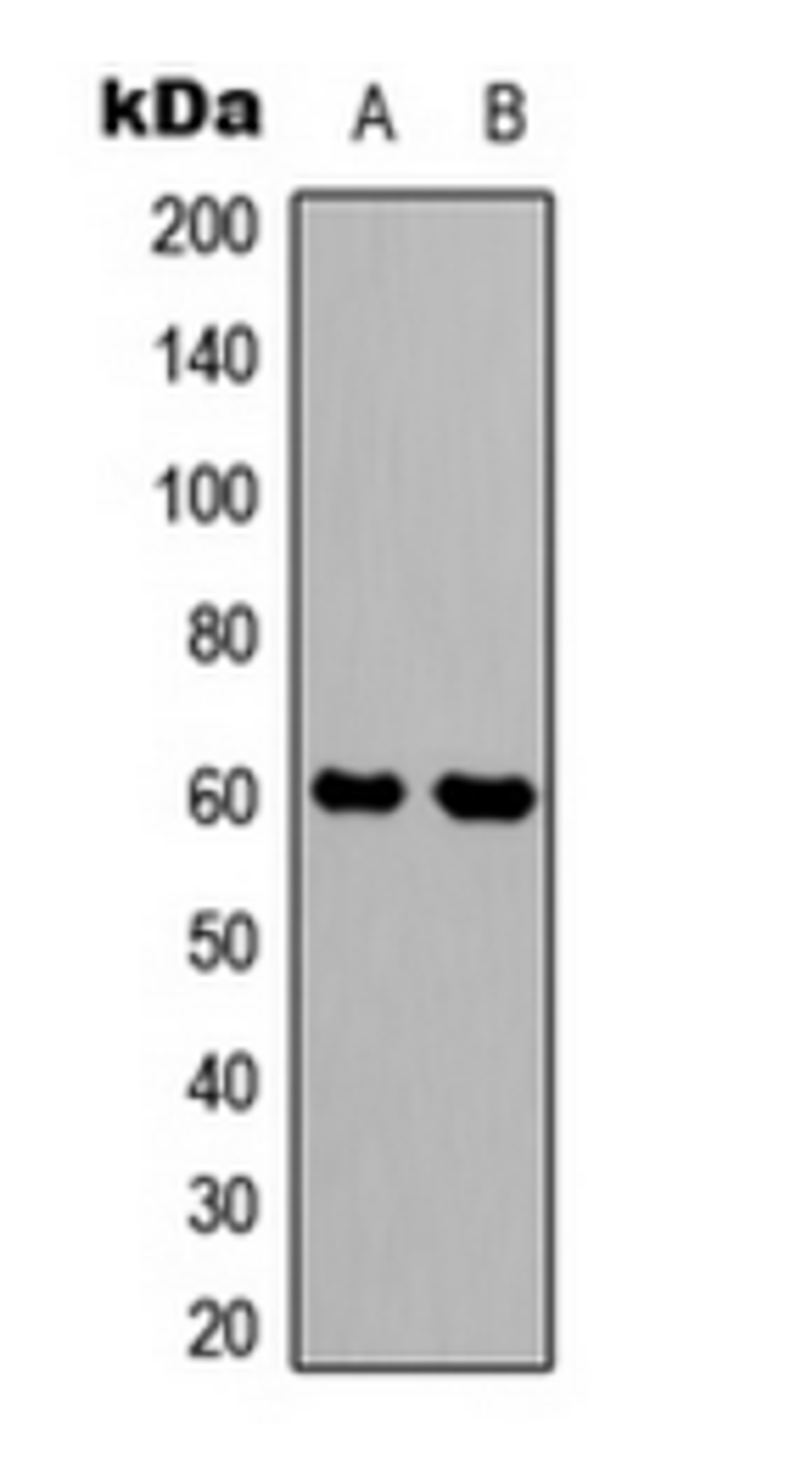 Western blot analysis of HEK293T (Lane 1), mouse brain (Lane 2) whole cell lysates using SYT1; SYT2 antibody