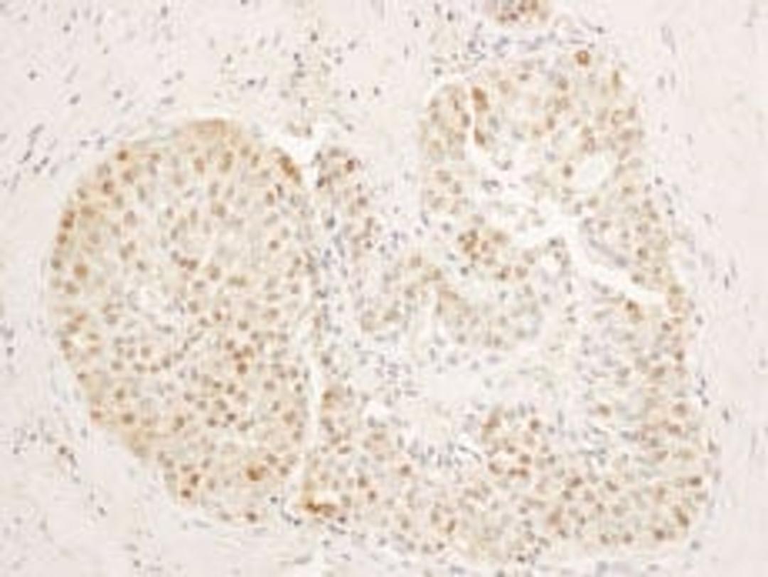 Detection of human SA1 by immunohistochemistry.