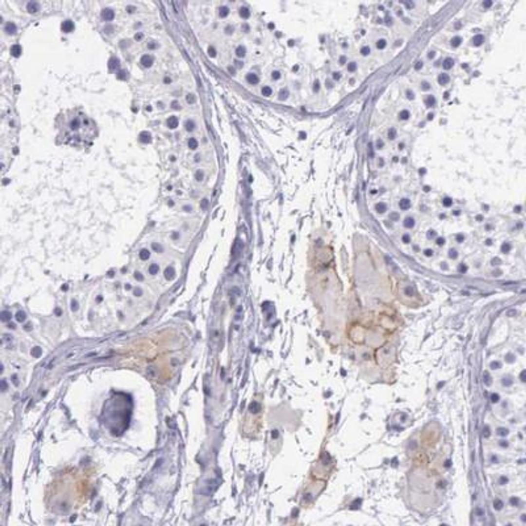 Immunohistochemistry: THSD7A Antibody [NBP1-93612] - Staining of human testis shows moderate membranous positivity in subsets of Leydig cells.