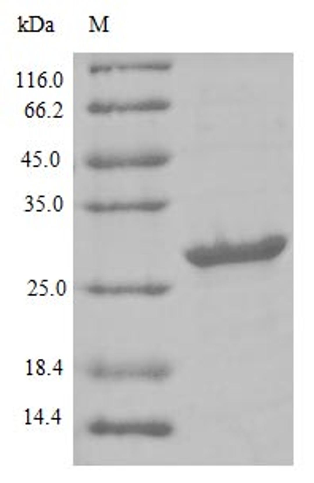 (Tris-Glycine gel) Discontinuous SDS-PAGE (reduced) with 5% enrichment gel and 15% separation gel.
